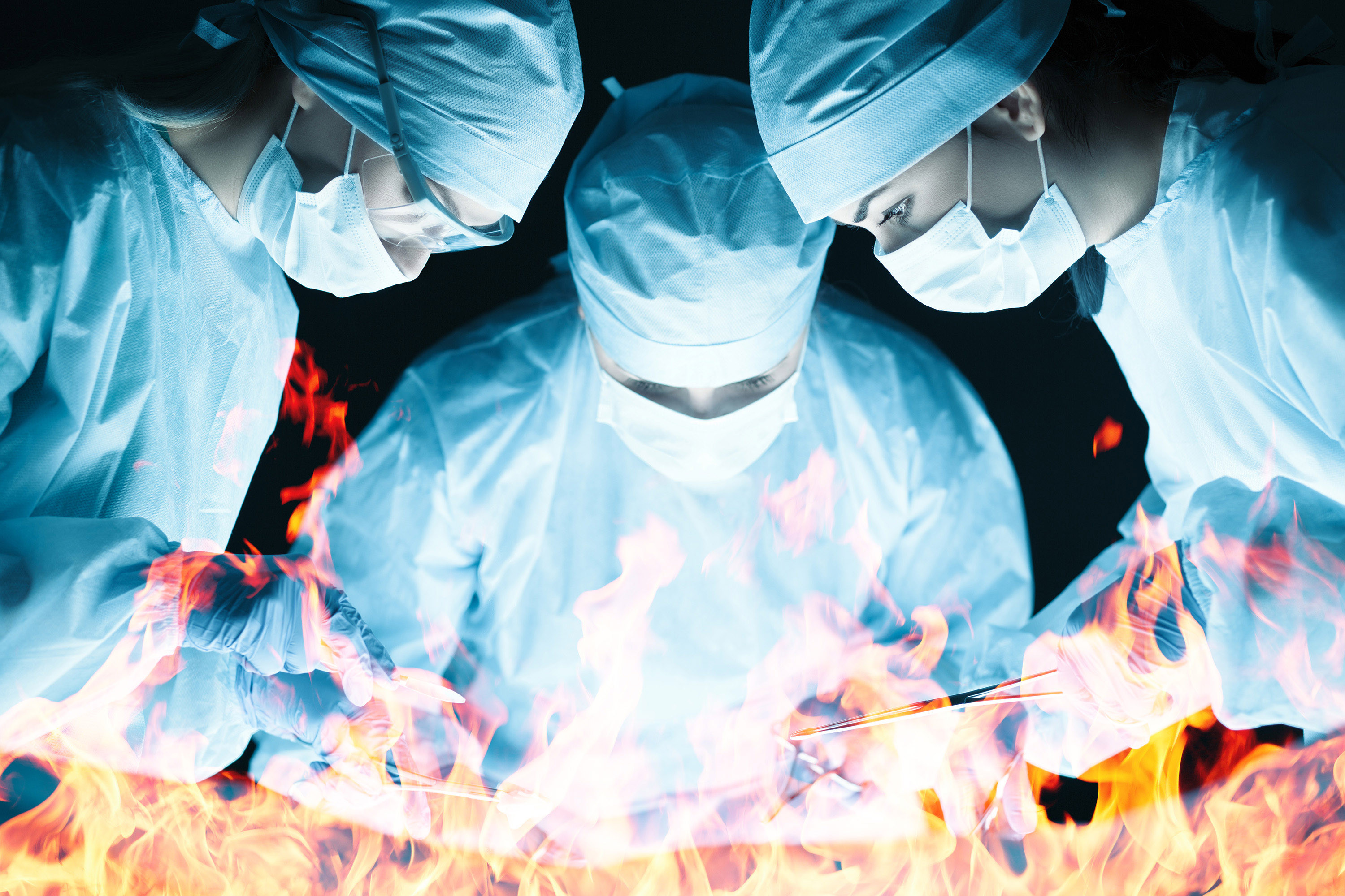 Flatulenţa din timpul unei intervenţii chirurgicale poate cauza incendiu