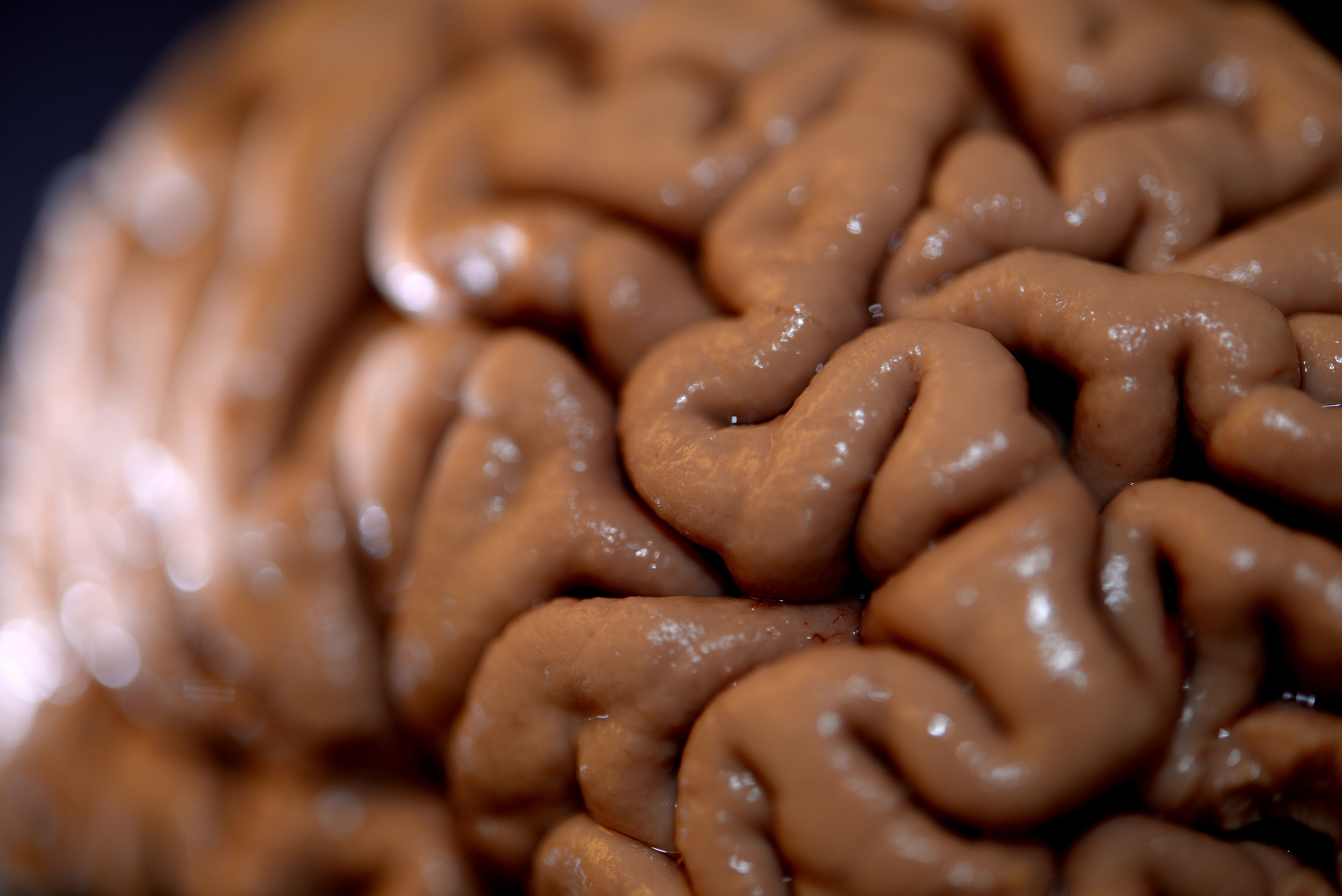 Consumul regulat de cacao este foarte bun pentru creier
