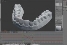 Acest tip şi-a reparat dinţii prin imprimarea 3D a propriului aparat ortodontic