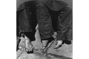 O comparatie intre o femeie cu picioare normale (stanga) si o femeie cu picioarele legate in 1902