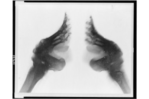 O radiografie a anatomiei picioarelor legate